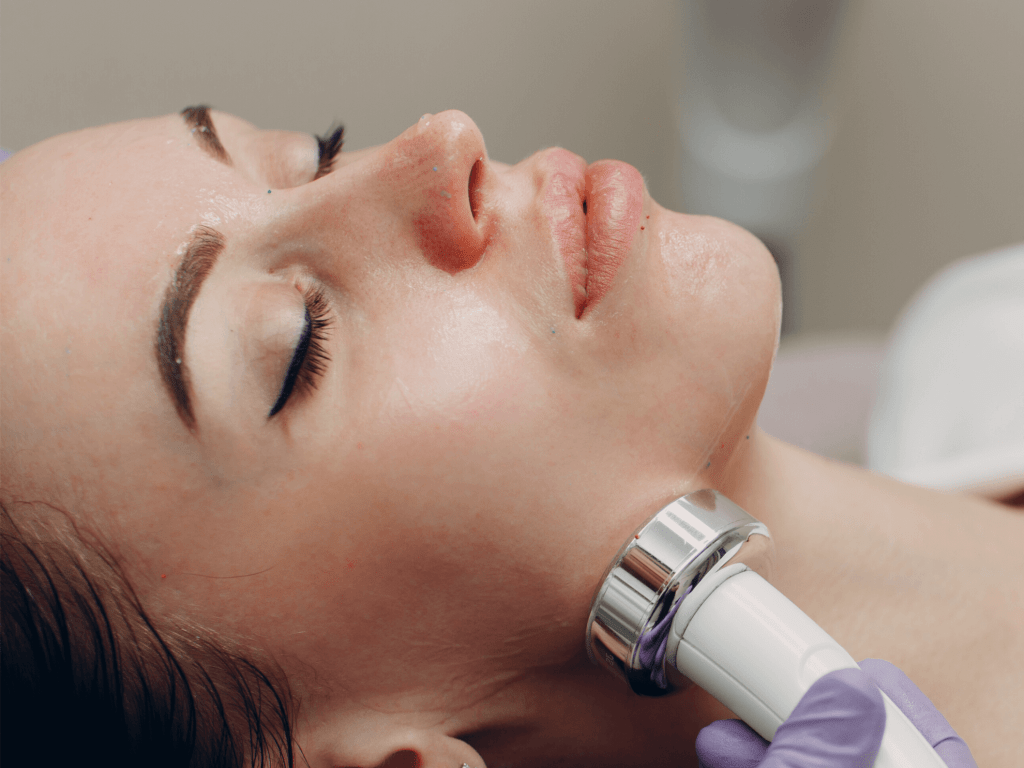 Radio Frequency facial